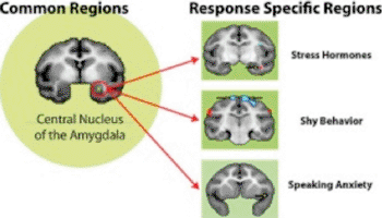 Image: The central nucleus of the amygdala is a core feature of anxiety across the presentation of different symptom patterns (left) and works through other selective brain regions that result in the diverse symptoms of extreme anxiety (right) (Photo courtesy of the University of Wisconsin School of Medicine and Public Health).